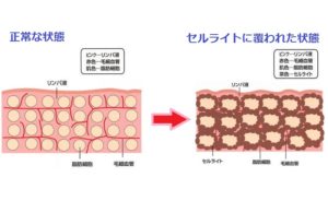 東十条駅から徒歩５分のパーソナルトレーニングに特化したスポーツジムのストレッチ&フィットネス２４十条店のブログの画像